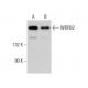 WDR62 Antibody (H-1) - Western Blotting - Image 376089 