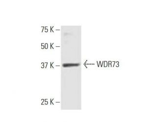 WDR73 Antibody (4A6) - Western Blotting - Image 352223SAM Transcription Activation: SAM system utilizing dCas9-VP64, MS2-P65-HSF1, and sgRNA for precise gene transcription activation.