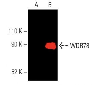 WDR78 Antibody (E-7) - Western Blotting - Image 402041 