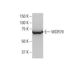 WDR79 Antibody (1F12) - Western Blotting - Image 352198 