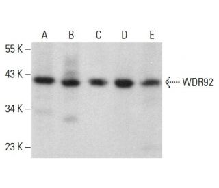 WDR92 Antibody (E-10) - Western Blotting - Image 376709 