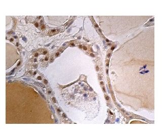 WHIP Antibody (A-7) - Immunohistochemistry - Image 160275 