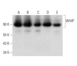 WHIP Antibody (A-8): sc-376438