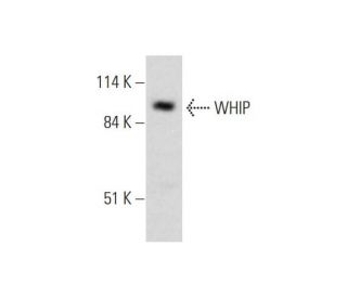 WHIP Antibody (C-10) - Western Blotting - Image 331156