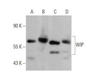 western blotting image from recommended WIP (C-1) monoclonal antibody replacement. Image 358723