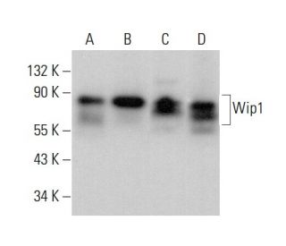 western blotting image from recommended Wip1 (F-10) monoclonal antibody replacement. Image 378784