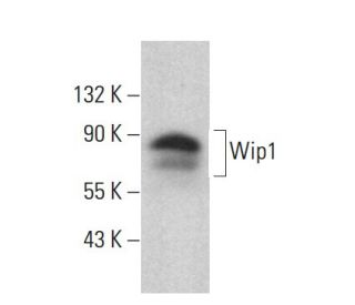 Wip1 Antibody (F-10) - Western Blotting - Image 383103Each CRISPR/Cas9 Knockout (KO) Plasmid product consists of a pool of 3 plasmids designed to ensure identification and cleavage of a specific gene for maximum knockout efficiency. Each plasmid encodes a unique 20 nt sequence derived from the GeCKO (v2) library.