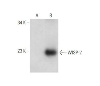western blotting image from recommended WISP-2 (B-5) monoclonal antibody replacement. Image 314527