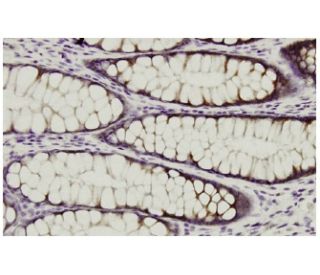 WNK2 Antibody (46.21) - Immunohistochemistry - Image 36031