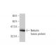 Nebulin Antibody (1F4) - Western Blotting - Image 348555