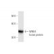 WNK4 Antibody (1E6) - Western Blotting - Image 350273 