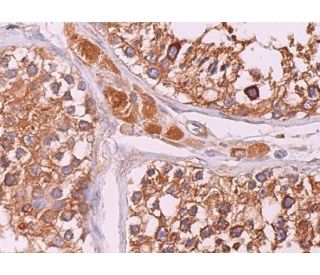 immunohistochemistry image from recommended Wnt-1 (E-10) monoclonal antibody replacement. Image 369230