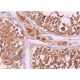 immunohistochemistry image from recommended Wnt-1 (E-10) monoclonal antibody replacement. Image 369230