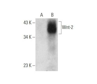 western blotting image from recommended Wnt-2 (E-7) monoclonal antibody replacement. Image 318604