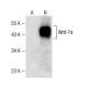 이 다클론 항체는 생산이 중단되었습니다. 권장 <a href="wnt-7a-b-antibody-h-8">Wnt-7a/b (H-8)</a> 단클론 항체(샘플 데이터 표시)를 참조하세요. western blotting image from recommended Wnt-7a/b (H-8) monoclonal antibody replacement. Image 141574