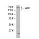 WRN Antibody (F-33) - Western Blotting - Image 34472 