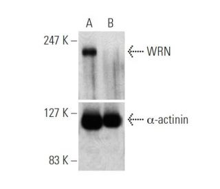WRN siRNA (h): sc-36843. Western blot analysis of WRN expression in non-transfected control (A) and WRN siRNA transfected 