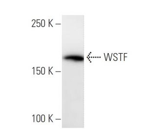 WSTF Antibody (BAZ1H4H9) - Western Blotting - Image 16838 