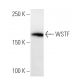 WSTF Antibody (BAZ1H4H9) - Western Blotting - Image 16838 