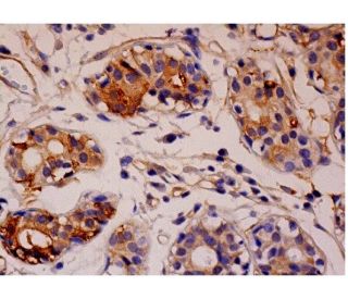 immunohistochemistry image from recommended WWOX (C-7) monoclonal antibody replacement. Image 286454