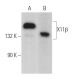 X11β Antibody (C-12) - Western Blotting - Image 369342 