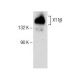 X11β Antibody (C-7) - Western Blotting - Image 156426 