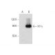 X11γ Antibody (A-2) - Western Blotting - Image 134510 