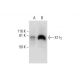 X11γ Antibody (B-6) - Western Blotting - Image 289953