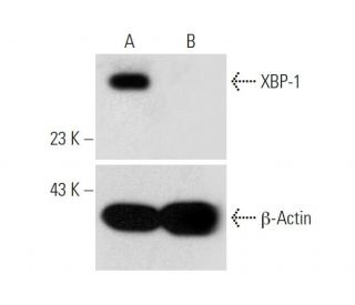 XBP-1 CRISPR/Cas9 KO Plasmid (m): sc-423727. Western blot analysis of mouse XBP-1 expression in empty vector control (A) aEach CRISPR/Cas9 Knockout (KO) Plasmid product consists of a pool of 3 plasmids designed to ensure identification and cleavage of a specific gene for maximum knockout efficiency. Each plasmid encodes a unique 20 nt sequence derived from the GeCKO (v2) library.