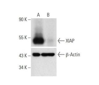 XIAP HDR Plasmid (h): sc-416497-HDR. Western blot analysis of XIAP... 