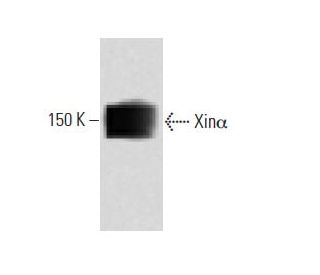 Xin&alpha; Antibody (41) - Western Blotting - Image 60511