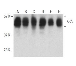 XPA Antibody (12F5) - Western Blotting - Image 398878 