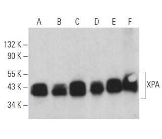 XPA Antibody (3F396) - Western Blotting - Image 357944 