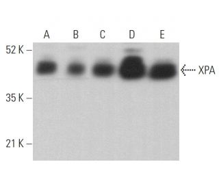 XPA Antibody (B-1) - Western Blotting - Image 359636 