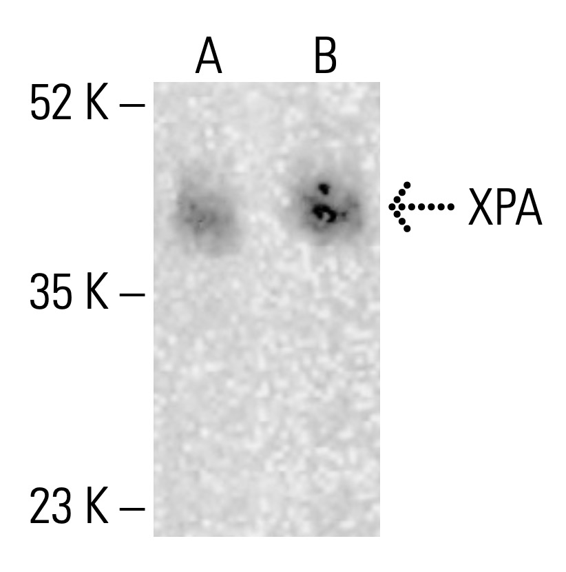 XPA Antibody (B-1) | SCBT - Santa Cruz Biotechnology