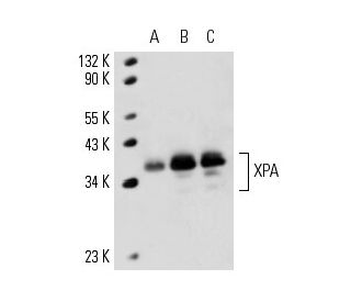 XPA Antibody (12F5) - Western Blotting - Image 15002