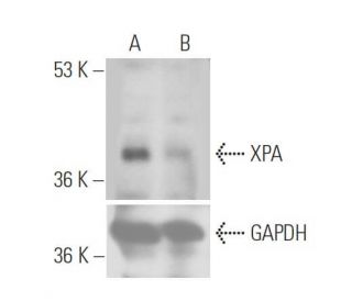XPA siRNA (h): sc-36853. Western blot analysis of XPA expression in non-transfected control (A) and XPA siRNA transfected 