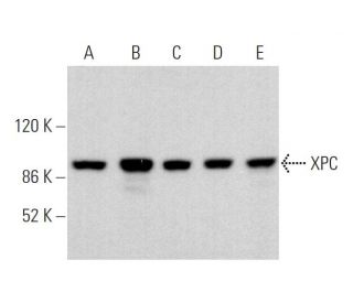 western blotting image from recommended XPC (D-10) monoclonal antibody replacement. Image 359662