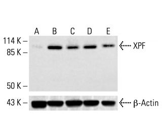 XPF Antibody (3F2/3) - Western Blotting - Image 412857