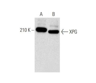 XPG Antibody (3C189) - Western Blotting - Image 134603 