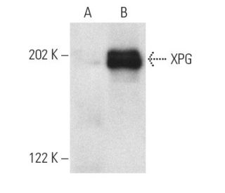 XPG Antibody (8H7) - Western Blotting - Image 1308