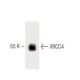 XRCC4 Antibody (4) - Western Blotting - Image 60495 