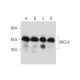 This polyclonal antibody has been discontinued. See our recommended <a href="xrcc4-antibody-c-4">XRCC4 (C-4)</a> monoclonal antibody (sample data shown). western blotting image from recommended XRCC4 (C-4) monoclonal antibody replacement. Image 129306