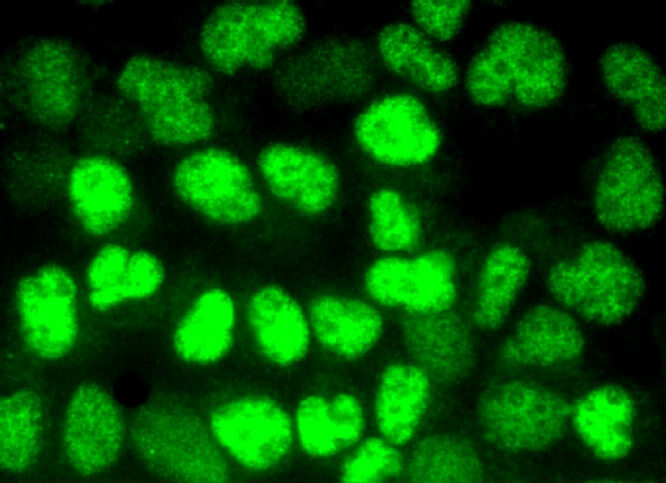 HADHB Antibody (E-1) | SCBT - Santa Cruz Biotechnology