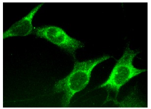 ルドルフ邪眼帝 yap-antibody-g-6-western-