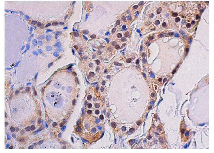 YAP Antibody (G-6) | SCBT - Santa Cruz Biotechnology