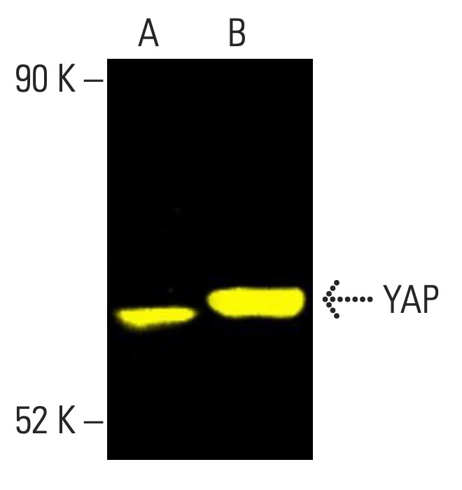 YAP Antibody (G-6) | SCBT - Santa Cruz Biotechnology