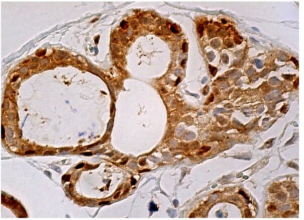 ポットマン様 yap-antibody-h-9-