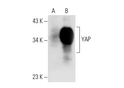 ATHLET プロキシマ YAP Antibody (H-9) | SCBT - Santa Cruz Biotechnology