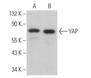 ATHLET プロキシマ YAP Antibody (H-9) | SCBT - Santa Cruz Biotechnology